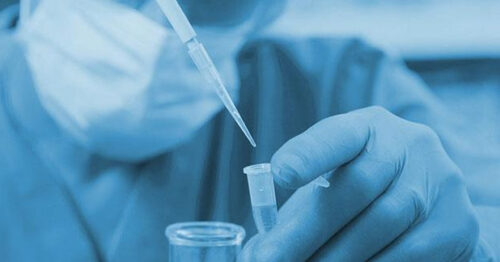 Man pipetting in a laboratory