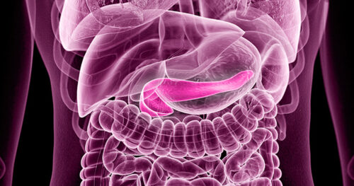 Pancreatits